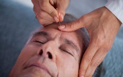 Effects of Acupuncture on Alzheimer’s