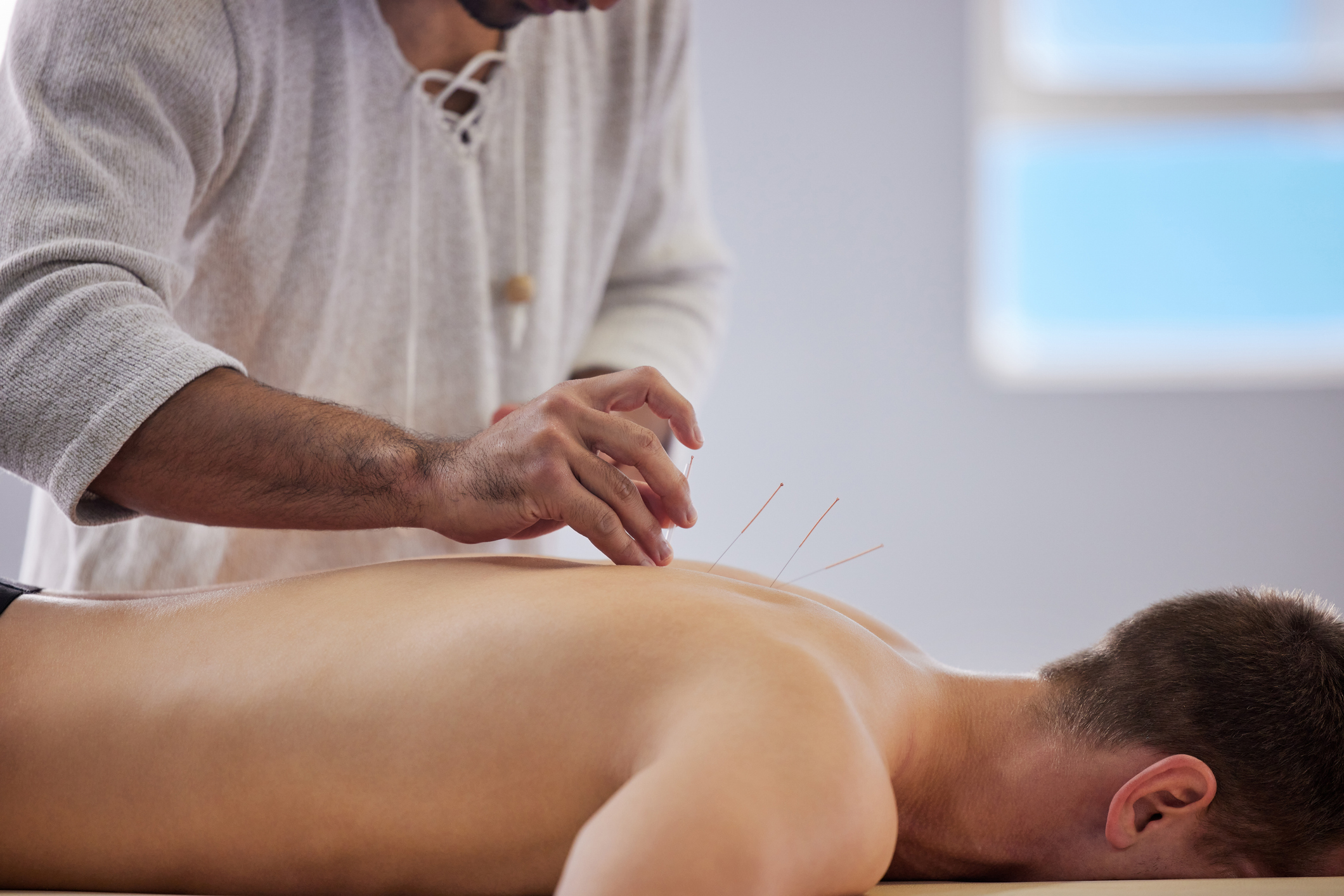 Shot of a acupuncturist treating a client A close-up of an acupuncturist carefully inserting thin needles into a man's bare back during a treatment session. The patient lies face down on a massage table in a calm, well-lit room, highlighting the practice of traditional Chinese medicine for pain relief and relaxation.